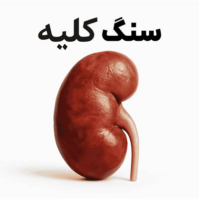 سنگ کلیه چیست؟
